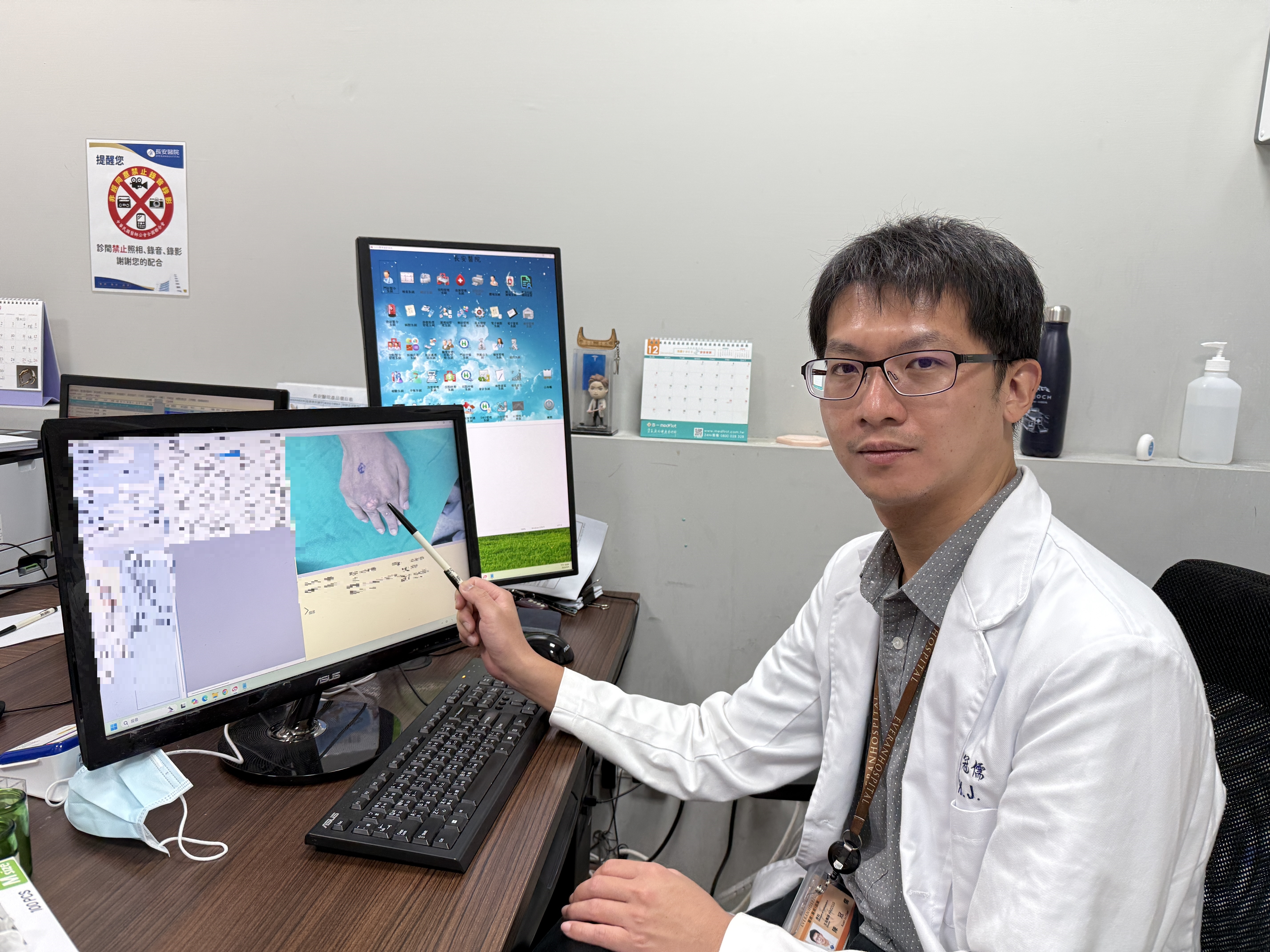 痛風石纏手10年險潰破　「微創痛風石切除手術」護關節