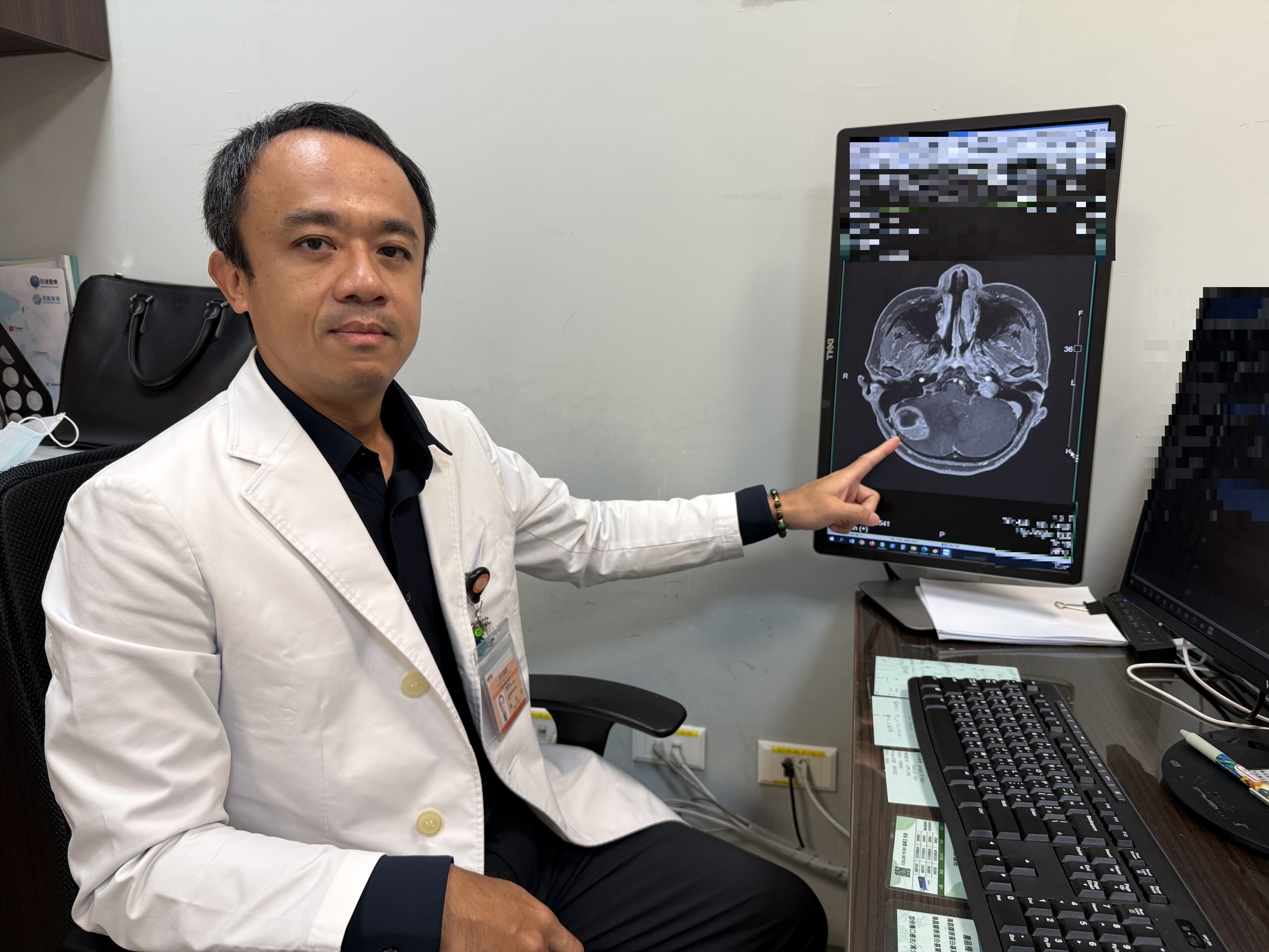頭暈嘔吐以為只是化療副作用？ 乳癌婦驚查小腦長3.7cm腫瘤！「3D導航+超音波腫瘤吸引器」精準拆彈